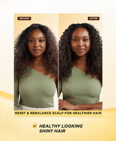 Scalp Treatment - Benefits 2