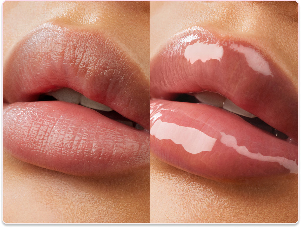 Lips before and after
